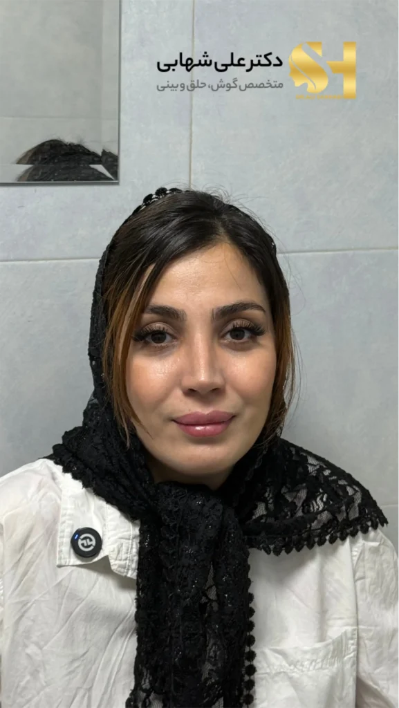 فرم نهایی بینی زیباجو در مطب دکتر شهابی