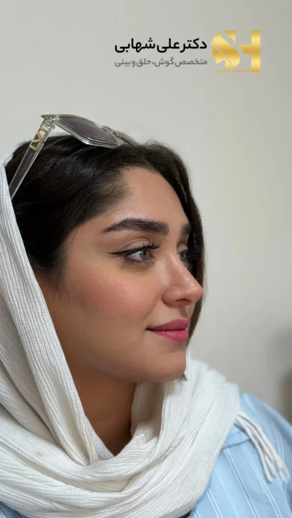 گالری تصاویر و نمونه کارهای دکتر علی شهابی بعد از برداشتن تامپون