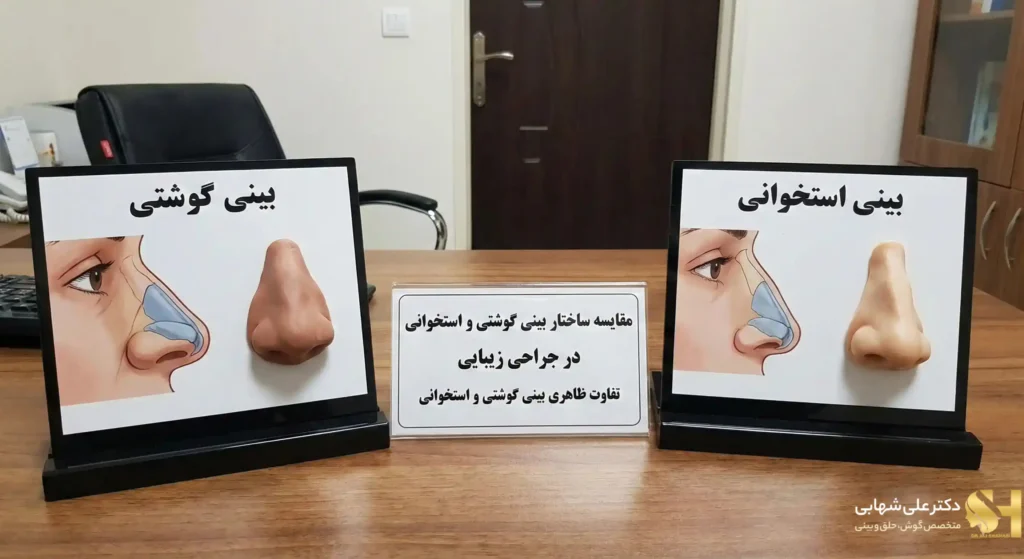 تفاوت بینی گوشتی و استخوانی در جراحی زیبایی