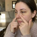 آموزش ماساژ بینی بعد از عمل (تصویری و اصولی) - دکتر علی شهابی