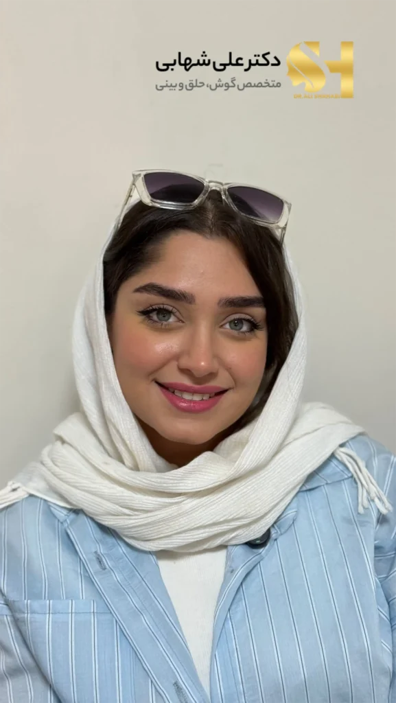 رضایت زیباجو از نتیجه عمل - نظرات درباره دکتر علی شهابی جراح بینی