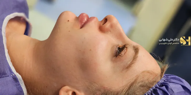 قبل از عمل. زیباجوی دکتر علی شهابی