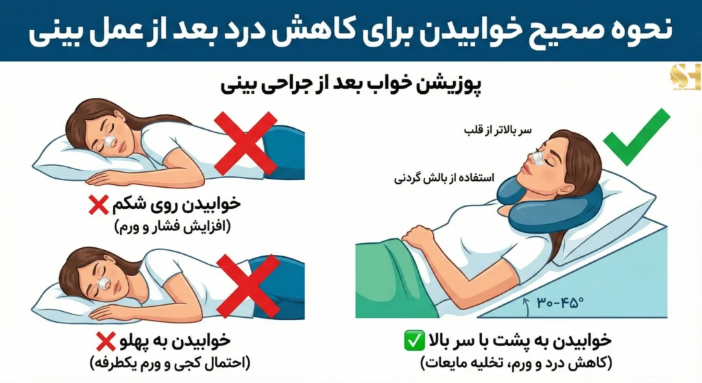 نحوه صحیح خوابیدن برای کاهش درد بعد از عمل بینی