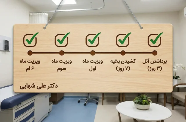 جدول زمانی عمل