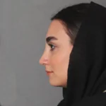 آموزش چسب زدن بینی