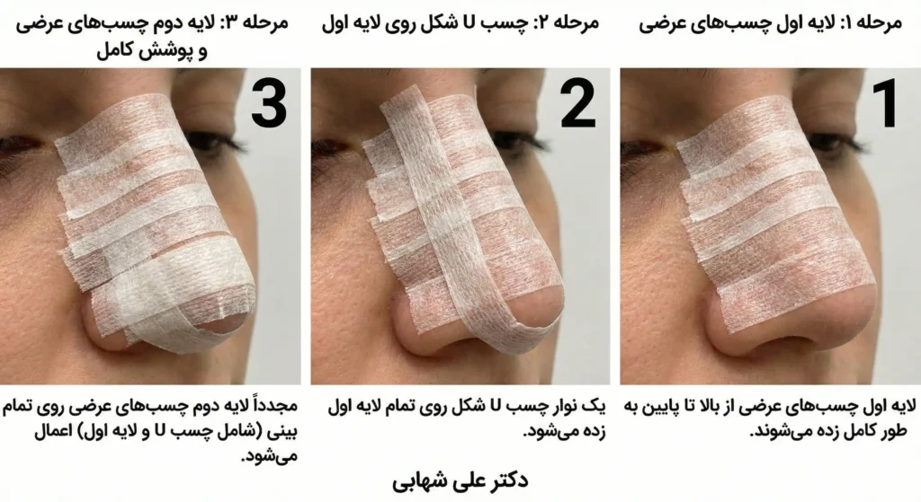 نحوه صحیح چسب زدن بینی توسط خود بیمار روی تیغه