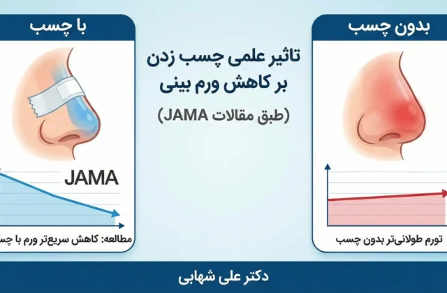 آموزش چسب زدن بینی