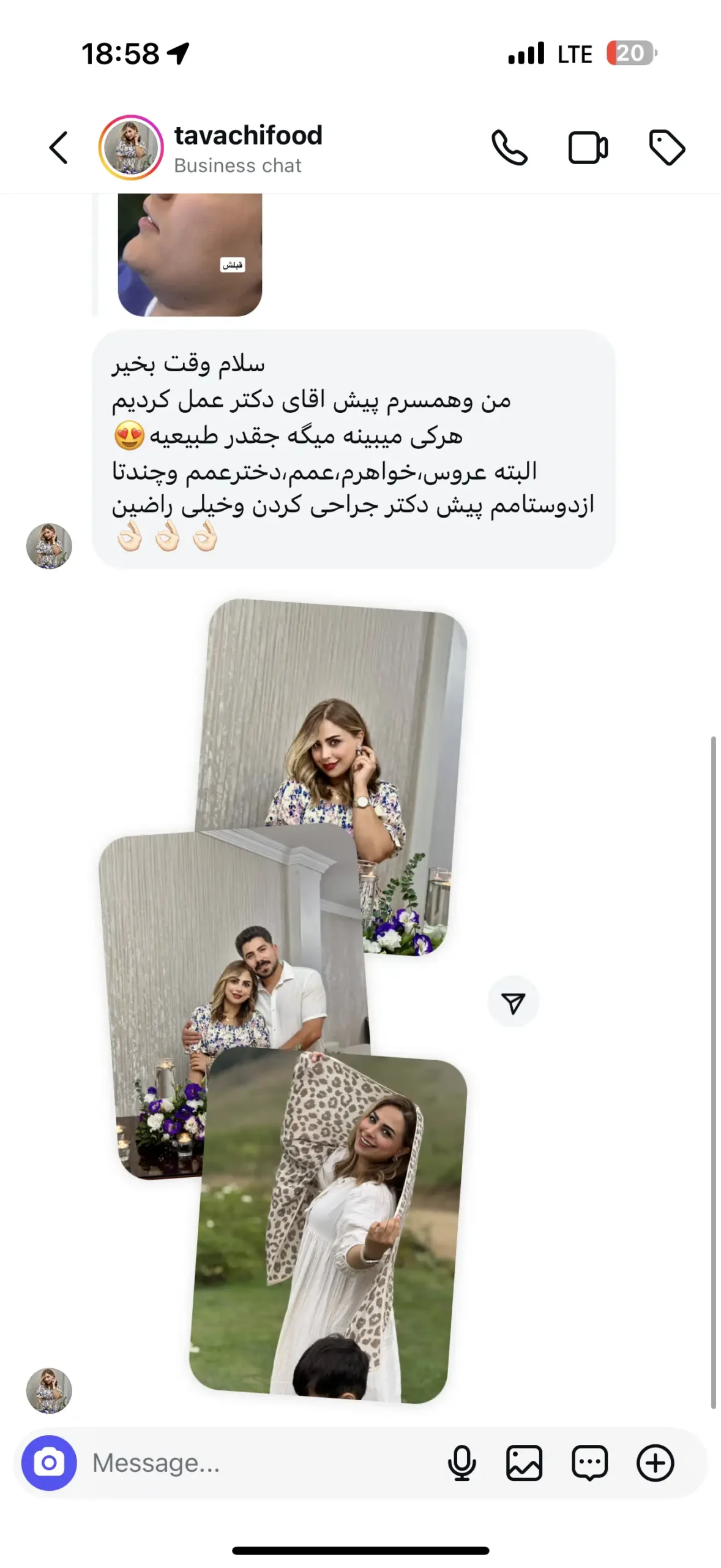 پیام رضایت مراجع ۶ و همسرشان از عمل بینی دکتر علی شهابی