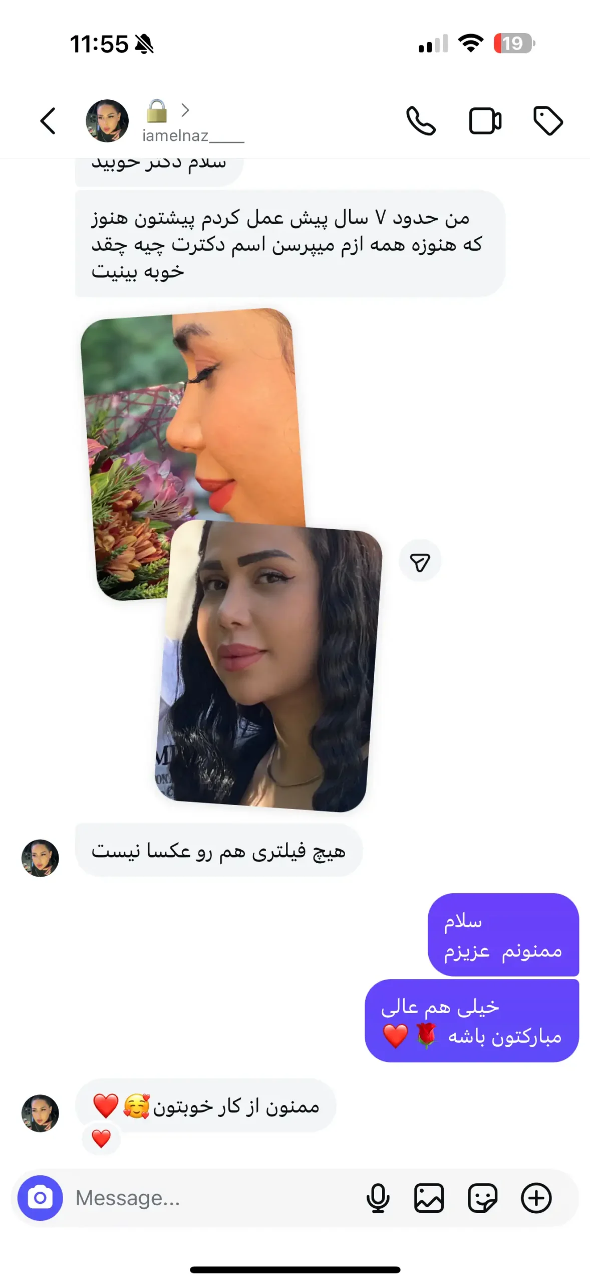 نظر مراجع ۵ پس از ۷ سال از عمل بینی دکتر علی شهابی