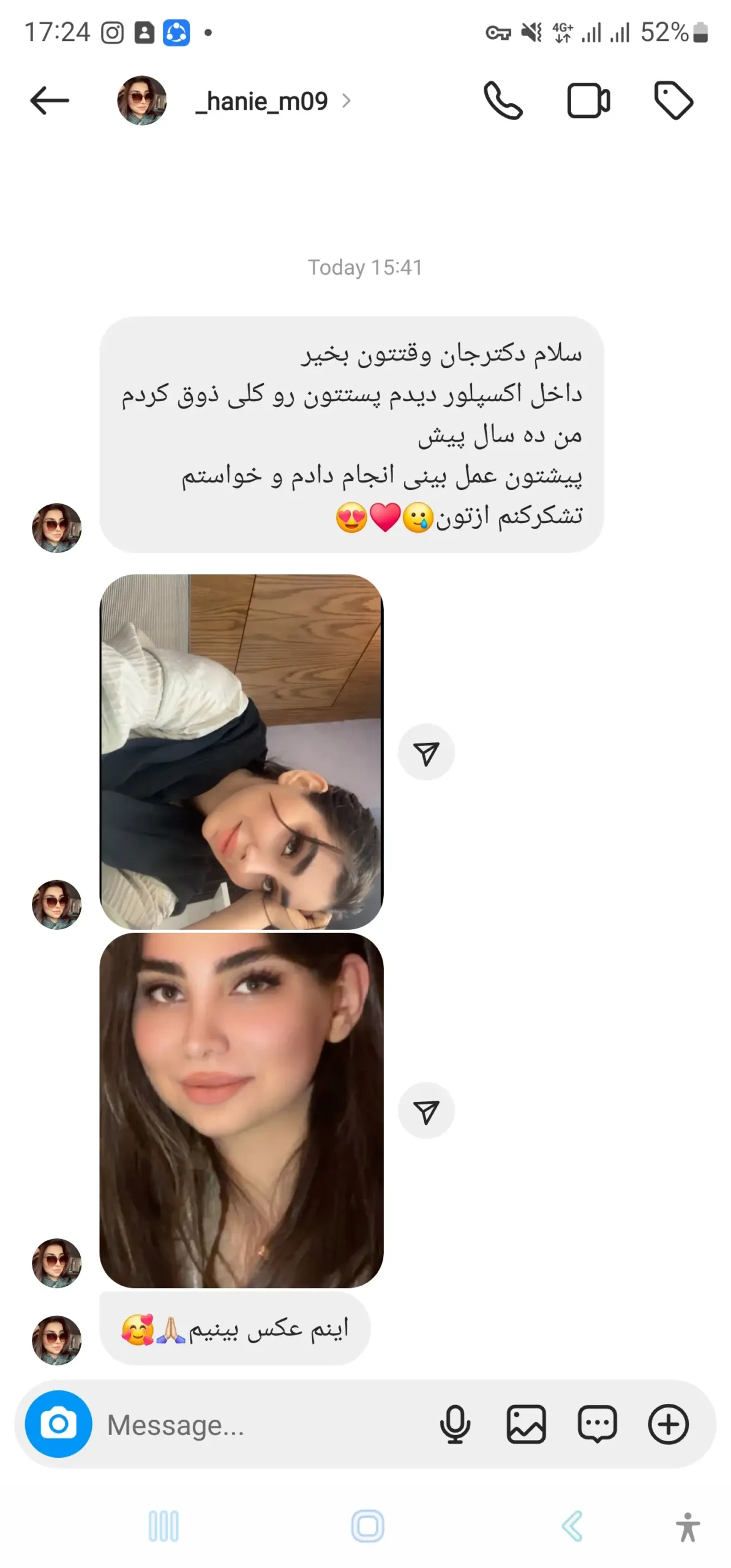 پیام رضایت مراجع ۱۰ پس از ۱۰ سال از عمل بینی