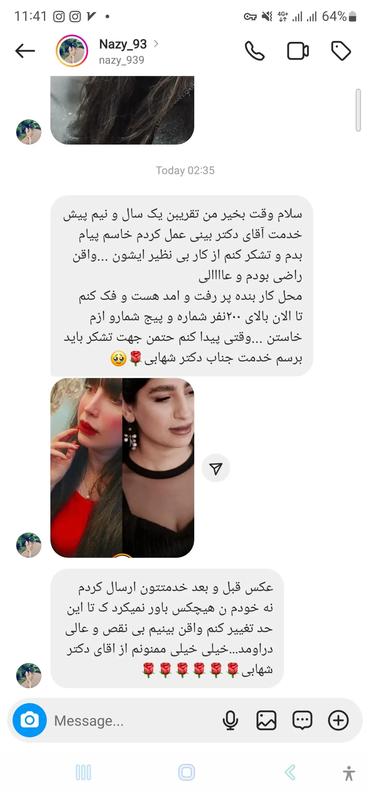 پیام رضایت مراجع ۷ پس از یک سال و نیم از عمل بینی