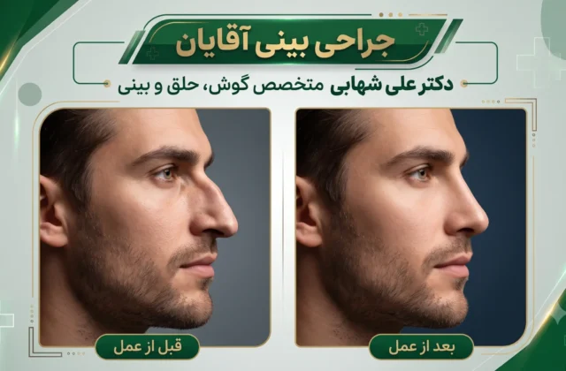 عمل بینی مردانه